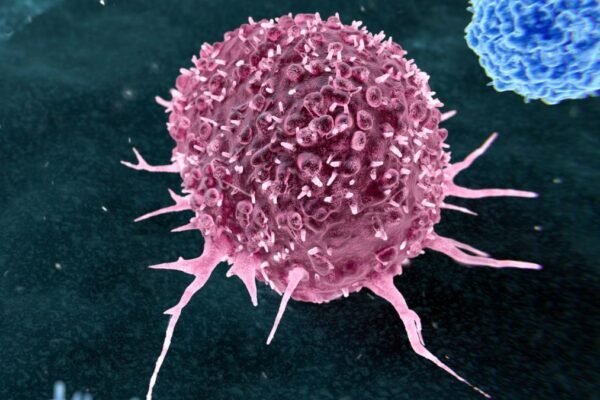 Sebagian besar kanker yang dapat dicegah terkait dengan dua kebiasaan gaya hidup saja.